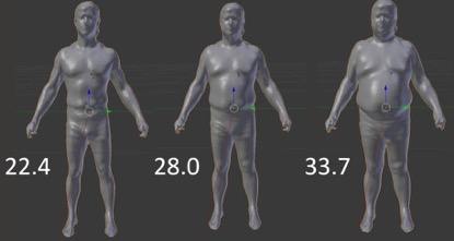 3D OPTICAL BODY SCAN EXAMPLE